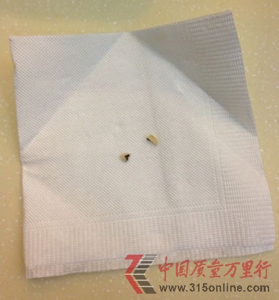 市民劉先生在萬(wàn)和春就餐時(shí)崩落的烤瓷牙碎片